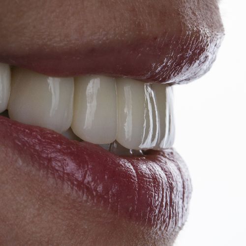 Implanty zębowe Wrocław